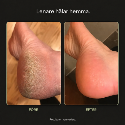 VIREVA — Före och efter fotvård