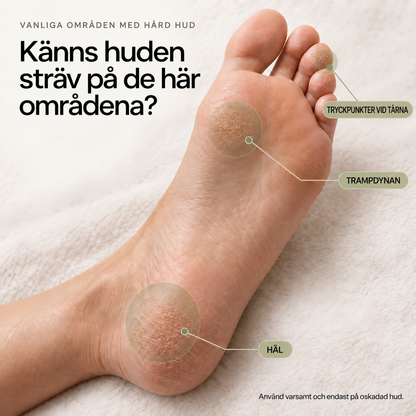 VIREVA — Vanliga områden med sträv hud